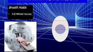 Breath Hold Technique - Conventional Radiation Therapy Systems (IMRT-IGRT)
