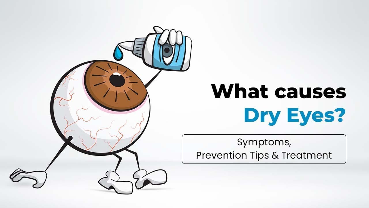 What causes Dry Eyes? Symptoms, Prevention Tips and Treatment YouTube