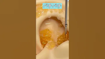 実際にあったら耳が壊れる4種類の耳かき 