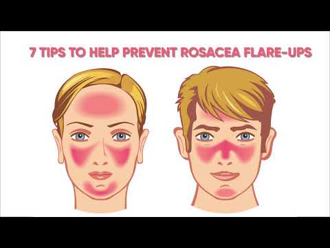 Video: Hoe Mijn Rosy Rosacea Flare-Ups Mijn Huid Laten Stralen