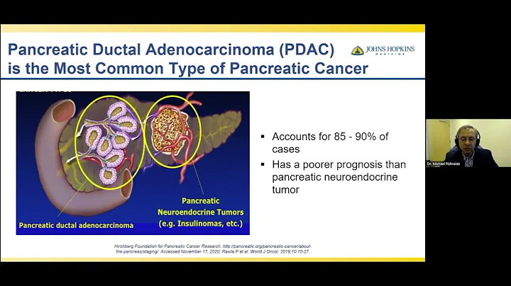 Updates in Pancreatic Cancer: 2022 - Michael Pishvaian, MD, PhD