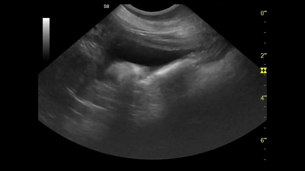 узи мочевого пузыря собаке