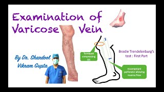 Examination of Varicose Vein for MBBS/ MS Surgery medical students