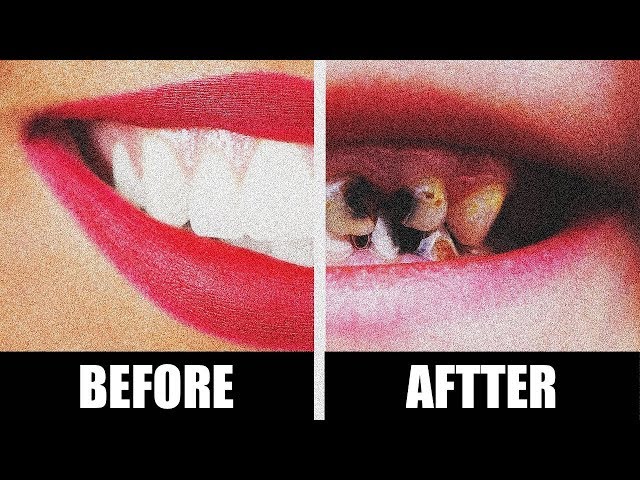 6 EXTREMELY Bad Habits That Are Ruing Your Health!