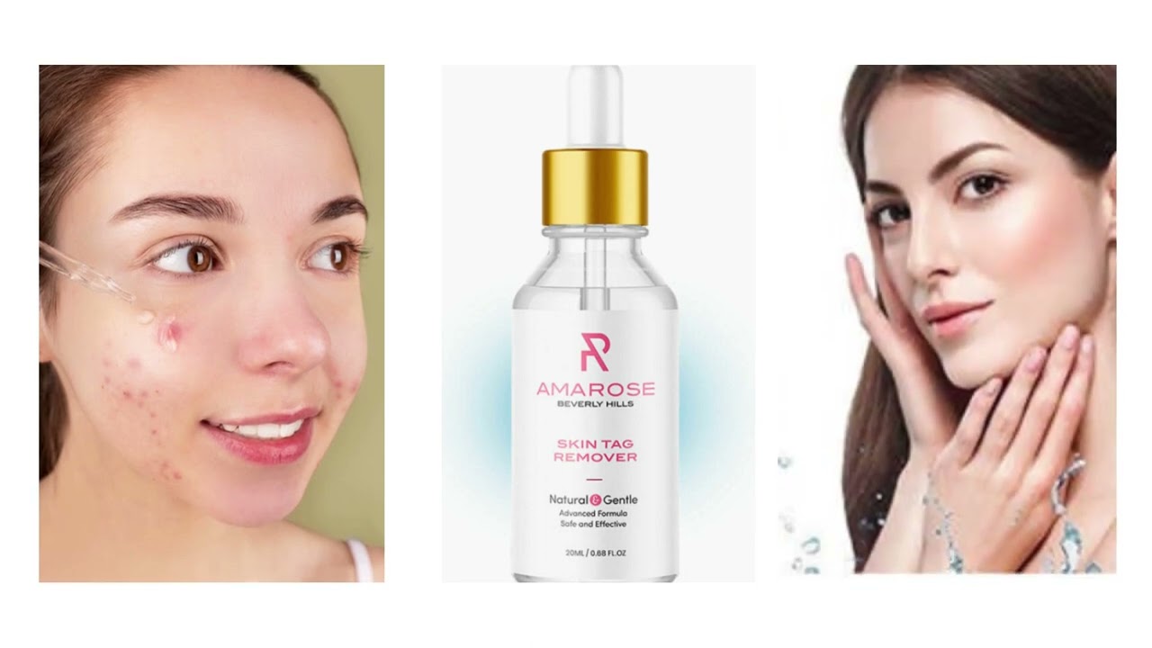 Amarose Skin Tag Remover Reviews | Does Amaeose Really Work | Amazon | Official Website