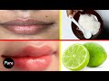 How To Get Baby Soft Pink Lips in Just 3 Day Naturally at Home