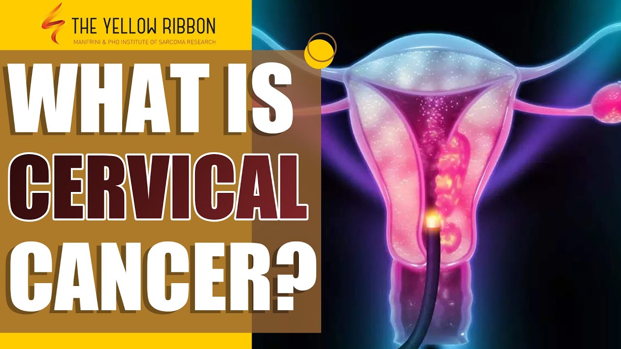 Hcg Ribbon 2 Best Ways to Prevent Cervical Cancer | The Yellow Ribbon | HCG | Dr ...