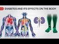 Diabetes Symptoms, Causes, and Effective Treatment Tips