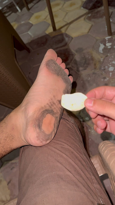 مقلب الجلدة في الشيبسي🍟😂#عبدالرحمن_الدسوقي