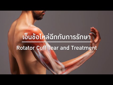 วีดีโอ: 3 วิธีง่ายๆ ในการระบุอาการบาดเจ็บที่ข้อมือของ Rotator