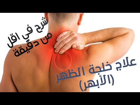 Back Trigger Point Treatment شرح بأقل من دقيقة علاج الأبهر خلجة الظهر Shorts Youtube