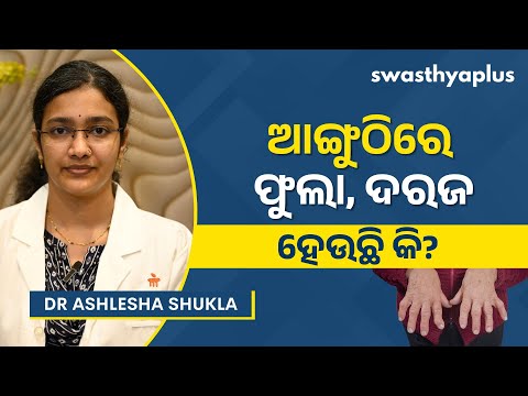 ରୁମାଟଏଡ୍‌ ଆର୍ଥ୍ରାଇଟିସ୍‌: କ’ଣ ରହିଛି ଚିକିତ୍ସା? | Rheumatoid Arthritis in Odia | Dr Ashlesha Shukla