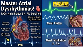 Master Atrial Dysrhythmias in Hindi: PACs, Atrial Flutter &amp; A. Fib | ECG Basics
