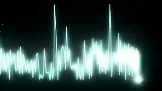 Equalizer