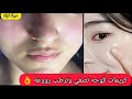 كريمات طبية تصفي وترطب ترجع البشرة صافية مراية وناعمة الملمس مثل بشرة الأطفال رووعة جربوهم تفهموني 