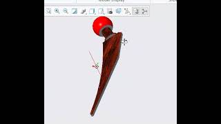 CAD Design of Hip Implant for Total Hip Replacement in Solidworks for injury biomedical Engineering