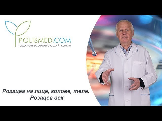Розацеа на лице, голове, теле. Розацеа век. Осложнения и последствия розацеа