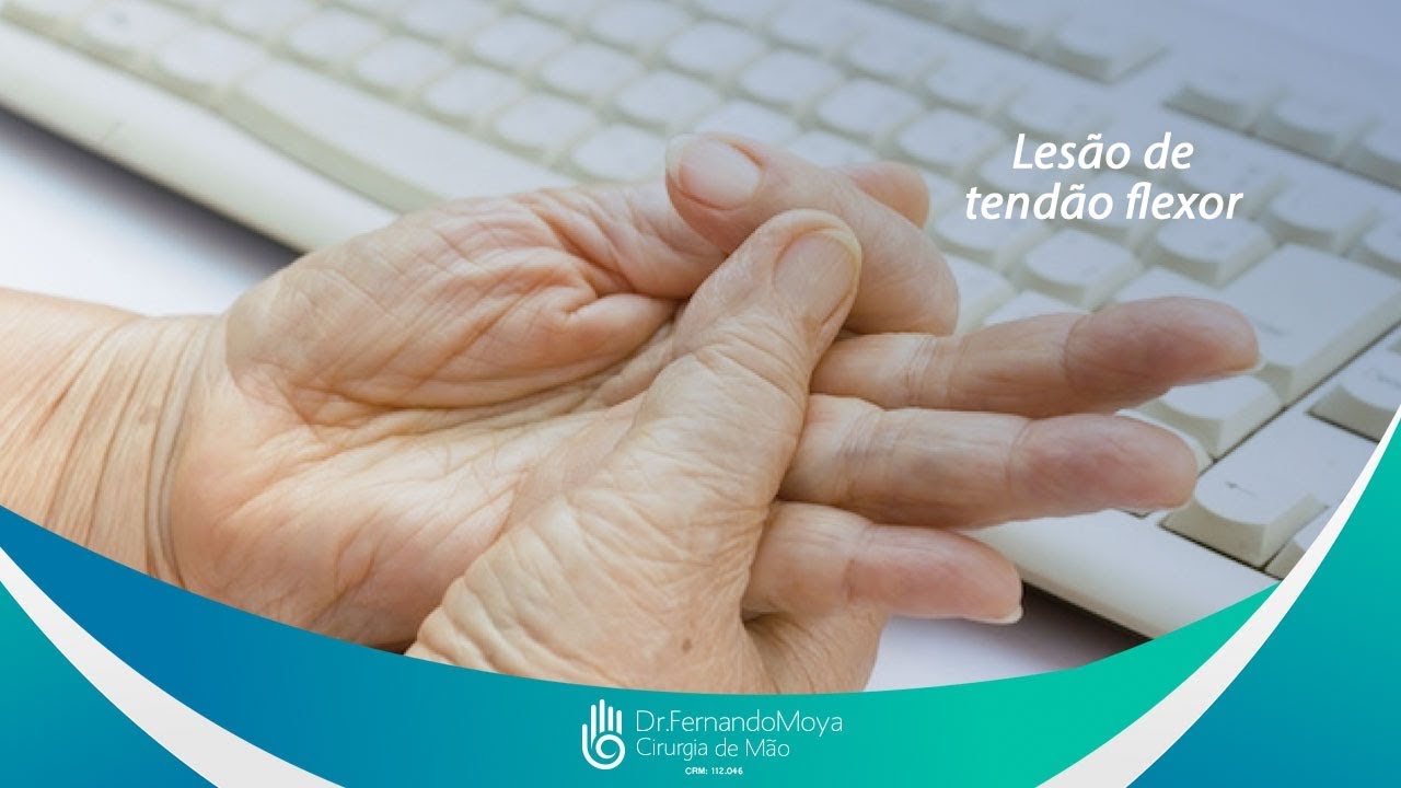 Lesão de tendão flexor e o dedo em gatilho | Dr. Fernando Moya CRM 112046