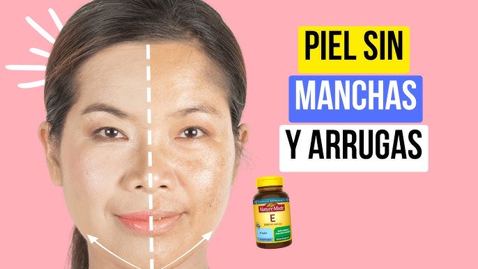 vitamina e para la piel quita las manchas 9 hq720