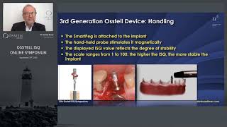 How to measure implant stability