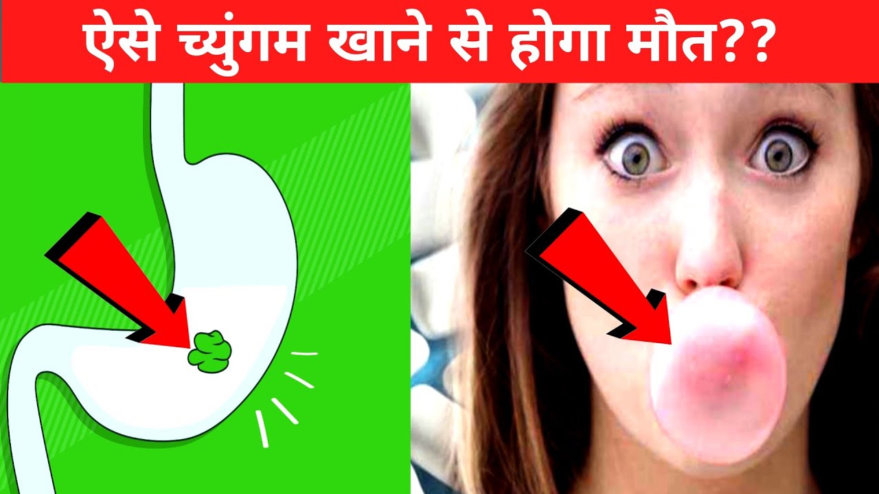 च्युंगम निगलने से क्या होता है ! Chingam nigalne se kya hota hai !