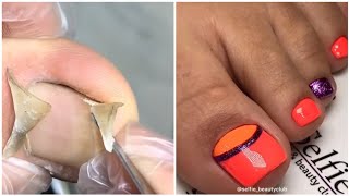 Most Satisfying Pedicure Transformation 😱 best nail polish for toes 2023