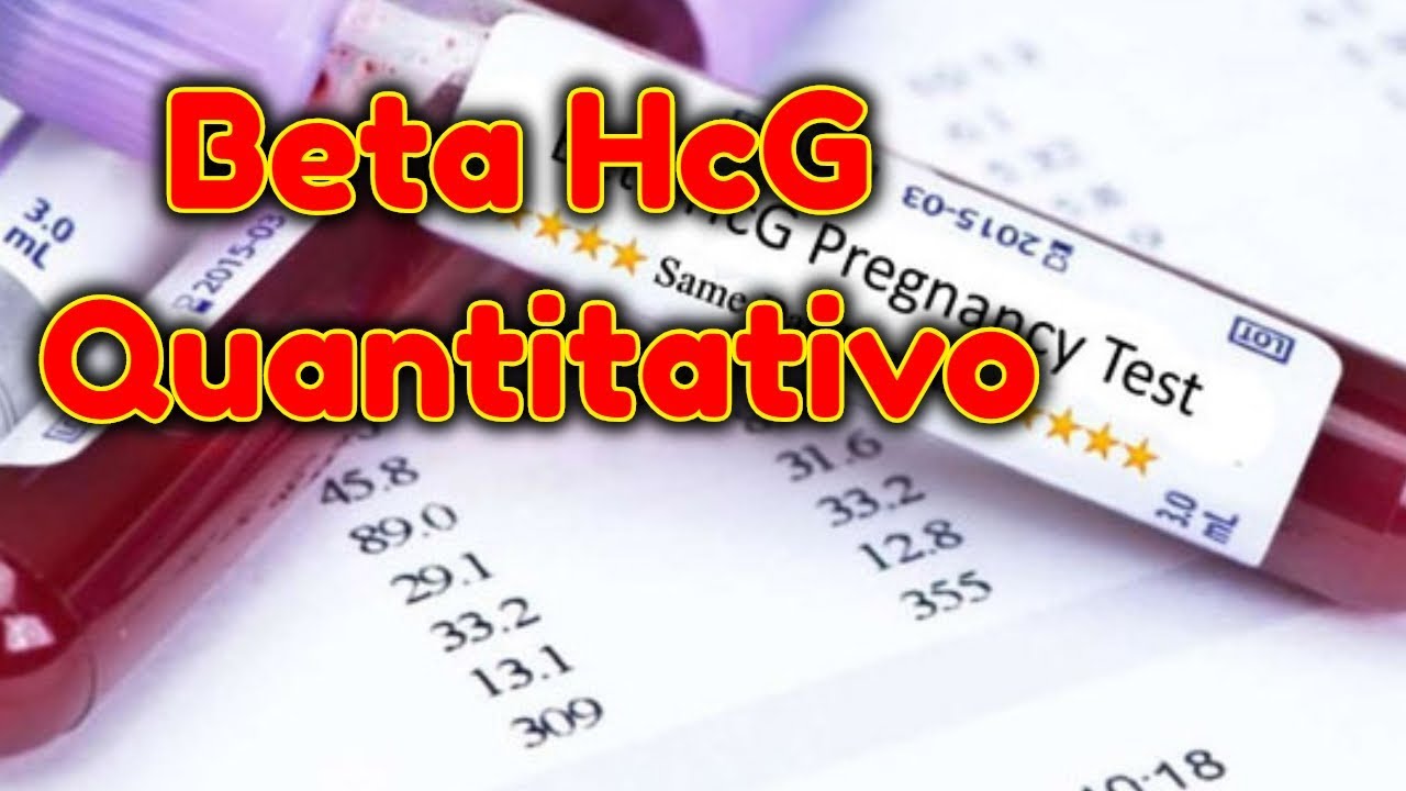 aposta gratis ao vivo betano