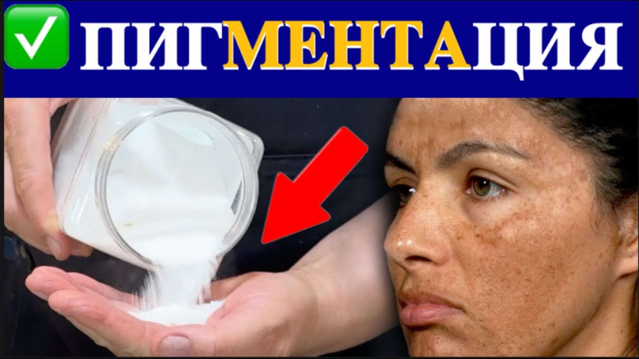 ОТ ТЕМНЫХ ПЯТЕН НА ЛИЦЕ. Почему об этом не рассказали раньше?