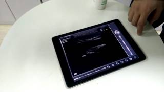 Sonostar 10.0MHz wireless linear probe video 04