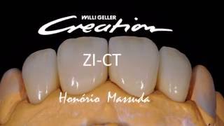 Aplicação Cerâmica Creation Zi-Ct