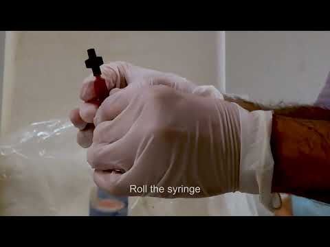 How to take a venous blood gas sample using a 'direct stab' technique thumbnail