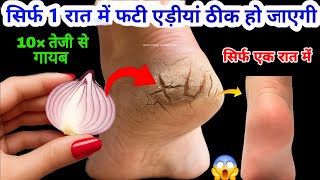 गारंटी है! 1 ही रात में ठीक हो जाएंगी फटी एड़ियांये जादुई उपाय एड़ी सॉफ्ट-मुलायम करेगा 😱 Cracked Heels screenshot 2