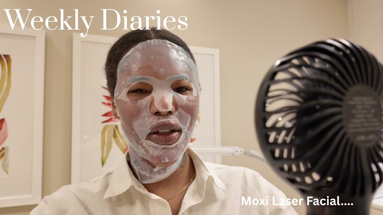 Weekly Diaries |  Moxi Laser Facial | NYC