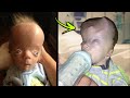 10 Most UNUSUAL Babies In The World