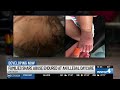 Parents speak out after infants injured at unlicensed Antioch daycare