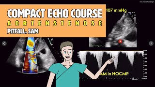 〖Echokardiografie〗 LVOT Obstruktion & SAM - Pitfalls der Aortenklappenstenose 🚨
