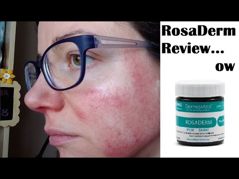 So...This Happened - DermaMed Rosaderm Review on Rosacea | Rosy JulieBC ...