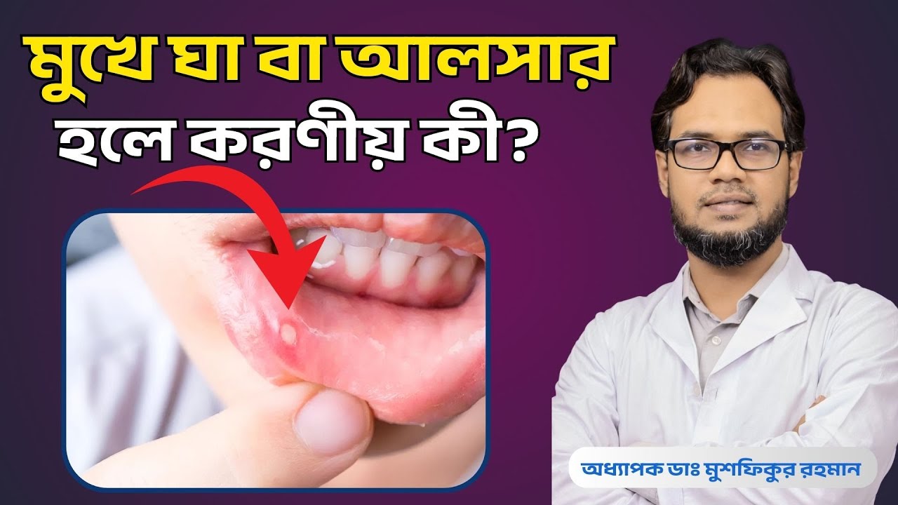 মুখে ঘা বা আলসার হলে করণীয় কী? কারণ, লক্ষন ও চিকিৎসা | Mouth Ulcer Home Remedy।DrMushfiqHealthcare 
