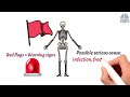 Intro: What Are MSK Red Flags 🚩 || November Redflag Awareness Series