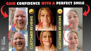 😁 Customer Reviews | Instant Smile teeth Veneers | Gain Confidence with a Perfect Smile | 2026