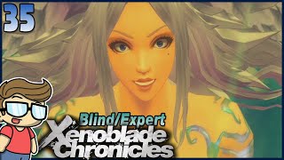 Lorithia Xenoblade Chronicles Definitive Edition Blind Expert - 35