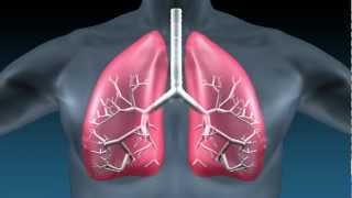 Pulmonary Fibrosis