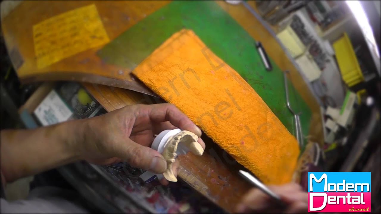 【歯科技工】ワックスアップ２ part1