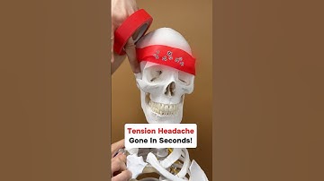 Tension Headaches Gone in SECONDS With This 3-Step Process! #headache #headachetreatment #tmj #jaw