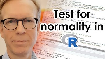 Test for normality in R