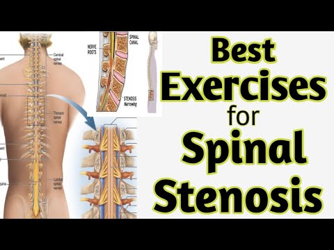 Best Exercises for Spinal Canal Stenosis,Lumbar Stenosis,Low Backpain ...