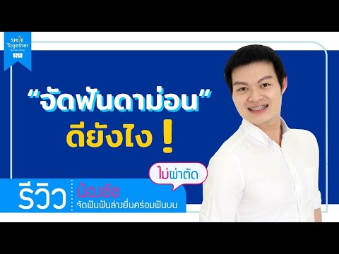 จัดฟันแบบดาม่อนดียังไง?::รีวิวเคส