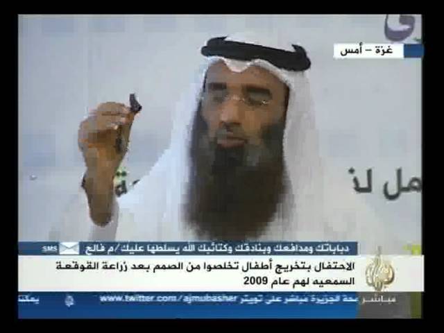 الإعلان عن تصنيع أول قوقعة سمعية عربية في غزة