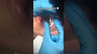 Can You Really Tattoo Your Teeth?! 😳🦷