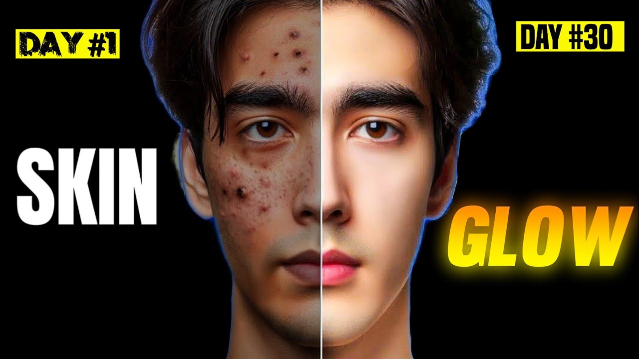 CLEAR & GLOWING SKIN IN JUST 30 DAYS NATURALLY | HOW TO GET CLEAR ...